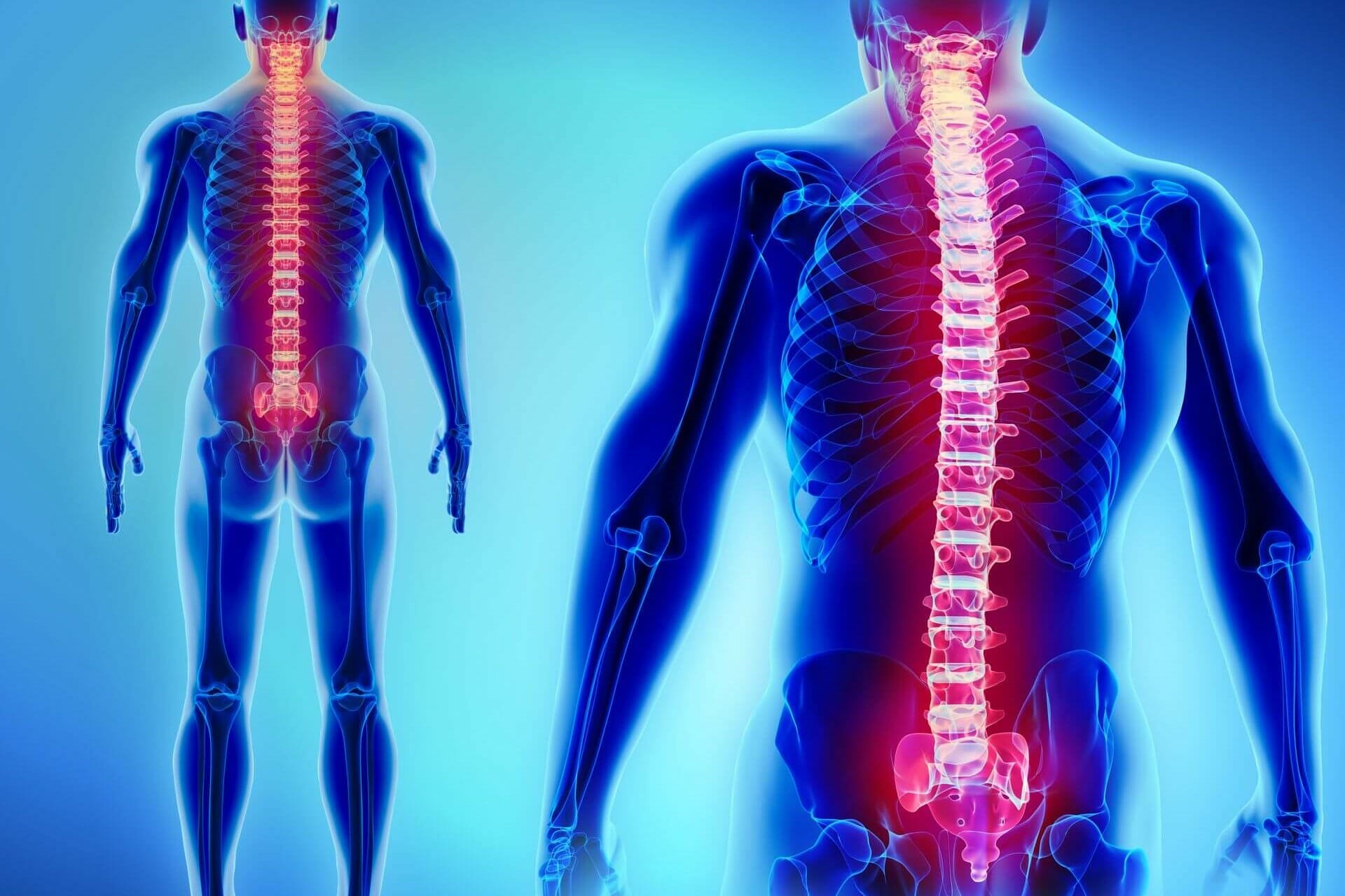 patologia-degenerativa-colonna-vertebrale-1